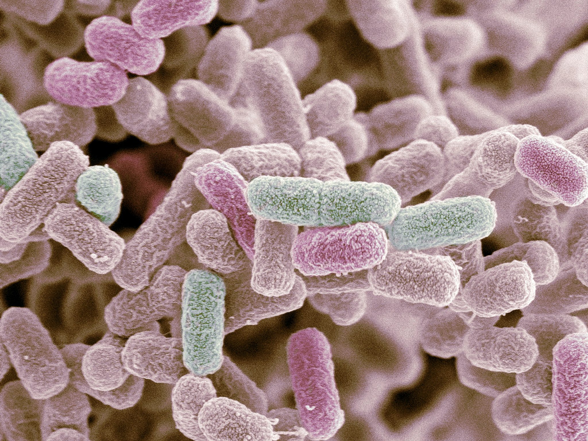آنتی سرم E.coli بهار افشان