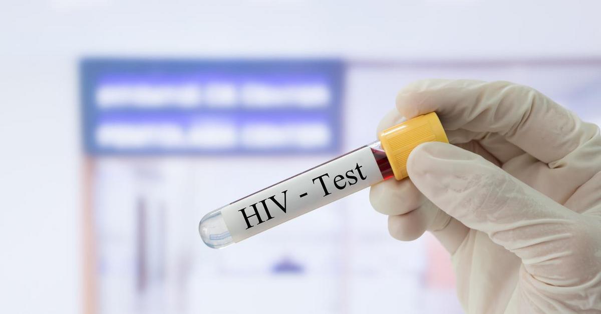 کیت تشخیص بیماری ایدز | شرکت آذرتشخیص آزما