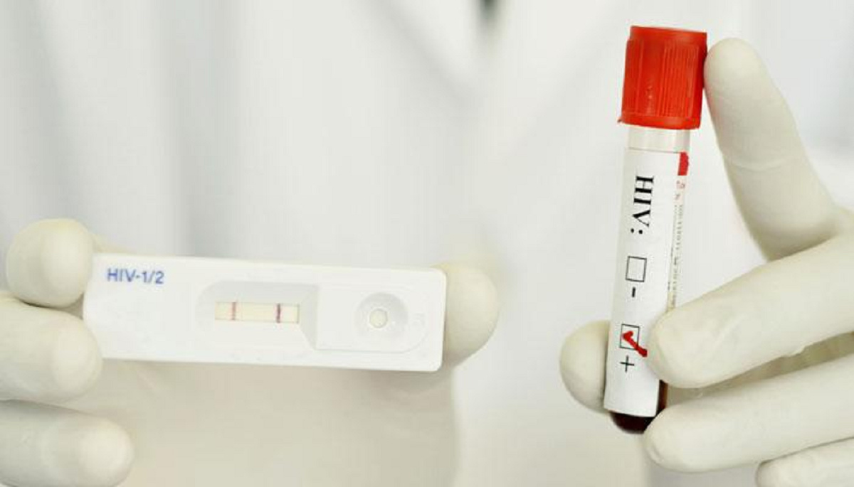 خرید کیت آزمایشگاهی ایدز در ارومیه | شرکت آذرتشخیص آزما